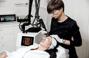 Ringiovanimento laser