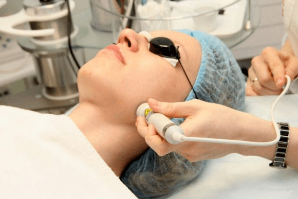 Biorevitalizzazione laser