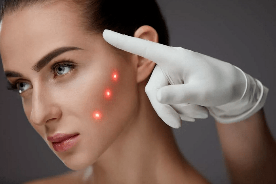 metodi di ringiovanimento